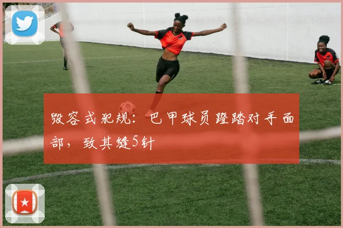 毁容式犯规：巴甲球员蹬踏对手面部，致其缝5针